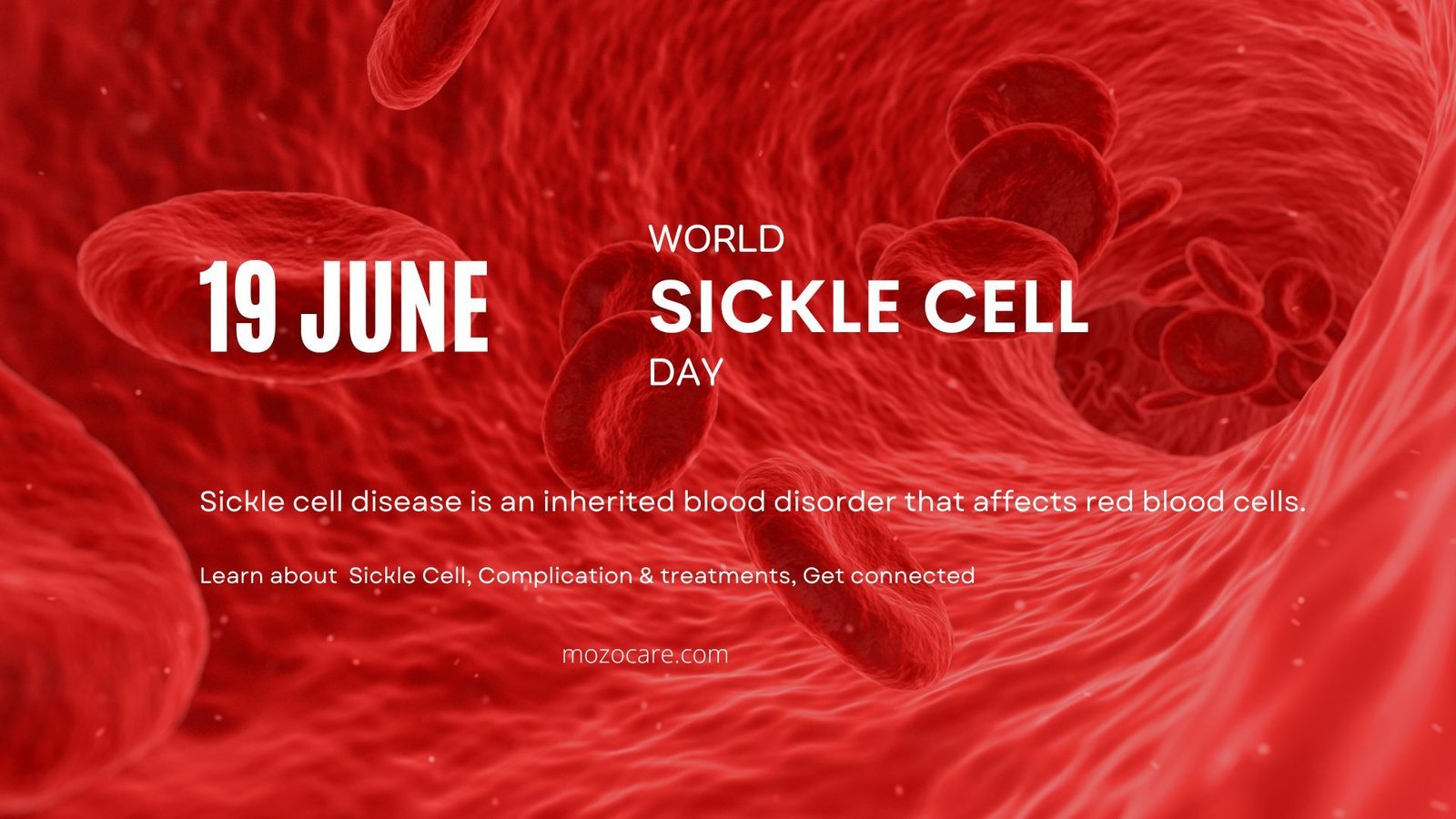 World Sickle Cell Day 2024 – Understanding Sickle Cell, Complications and Treatment