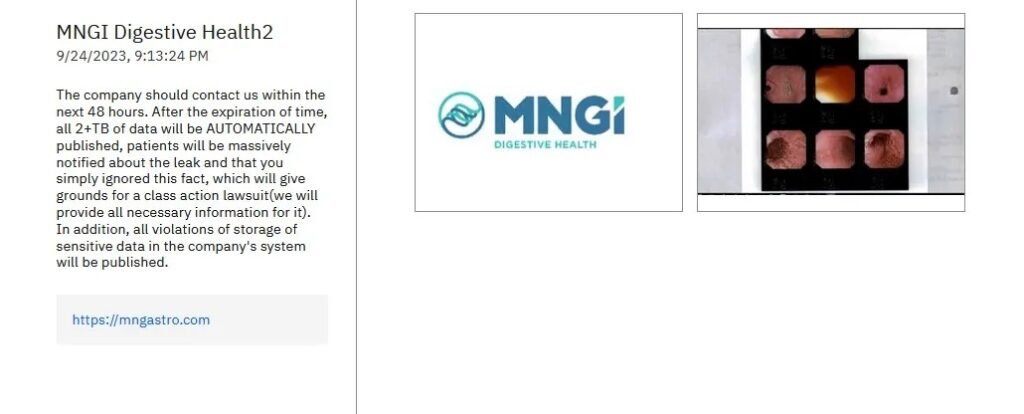 MNGI Digestive Health notifies 766K people about data breach that compromised SSNs, financial, and medical info