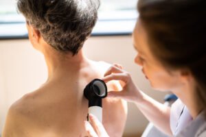 Why Is Older Skin More Prone to Skin Cancer?